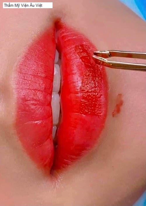 Bảng giá Thẩm Mỹ Viện Âu Việt