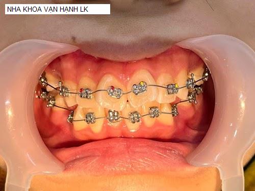 Hình ảnh NHA KHOA VẠN HẠNH LK