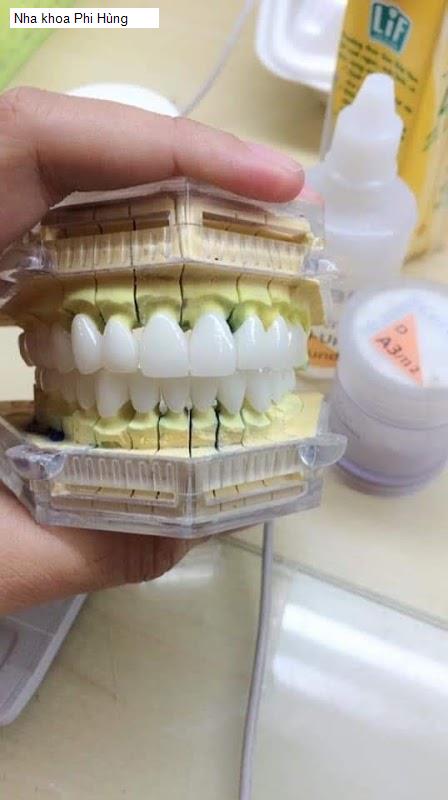 Hình ảnh Nha khoa Phi Hùng